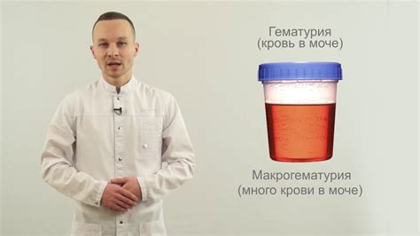 Причины артефактов в моче