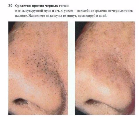 Причины появления черных точек на леще