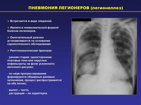 Причины секундарных изменений в легких
