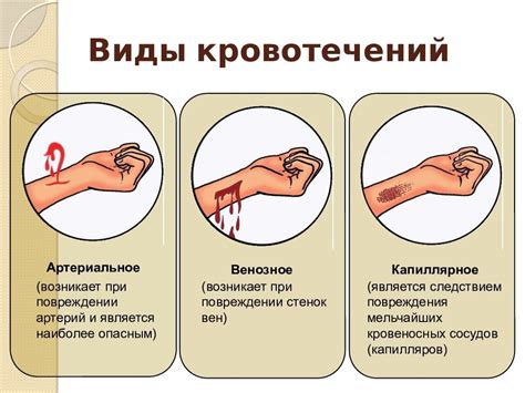 Профилактика и лечение после значительной потери крови