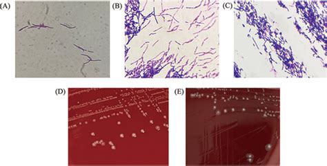 Профилактика повышения Clostridium ramosum в крови