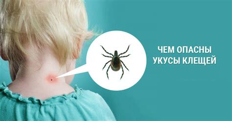 Профилактика укусов на шее