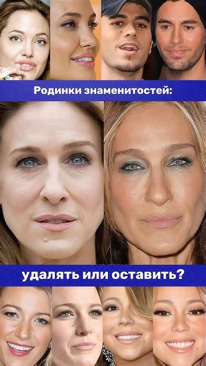 Родинки на лицах знаменитостей