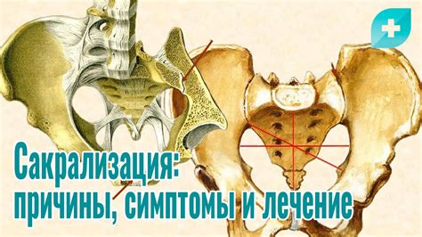 Сакрализация заключения