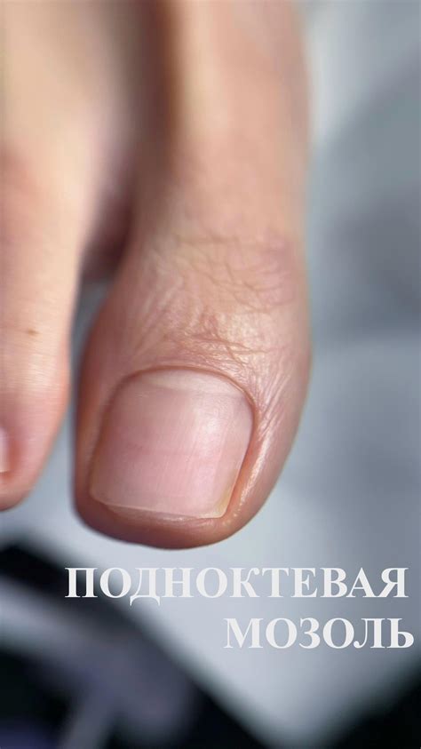 Следы спирта могут повредить кожу