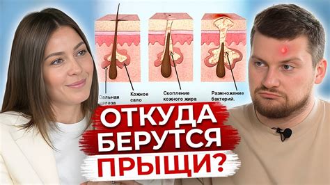 Сны о прыщах: популярность темы
