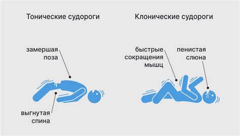 Сокращение ПКОНС