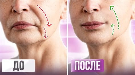 Увеличение ширины рта: эффективные способы и упражнения