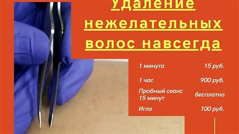 Удаление нежелательных операций из истории