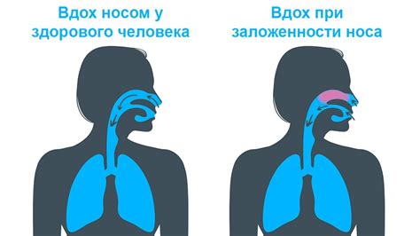 Улучшает функцию дыхания и предотвращает заложенность носа