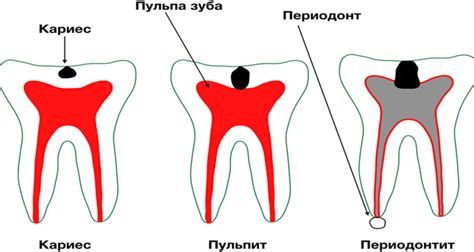 Что такое AVLS