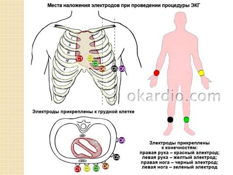 Шаги по настройке ЭКГ аппарата
