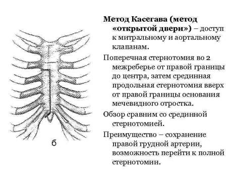 Шаг 2: Открываем доступ к клапанам
