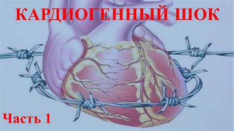 Шок