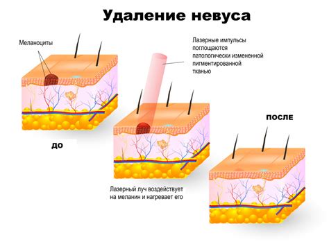  Что говорят родинки на щеке 