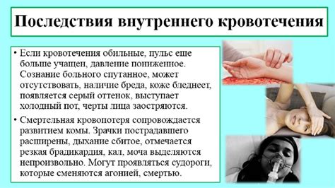 Вероятность внутреннего кровотечения