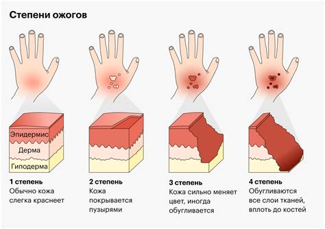 Восстановление кожи после ожога от веррукацида