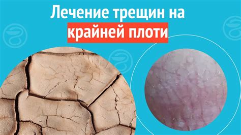 Выступления или опухания на коже