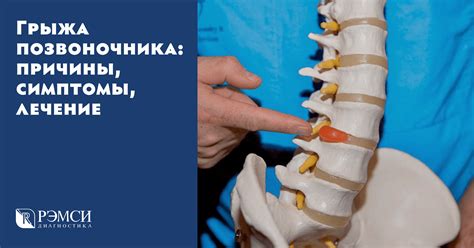 Как определить, что сохнет нога именно при грыже позвоночника