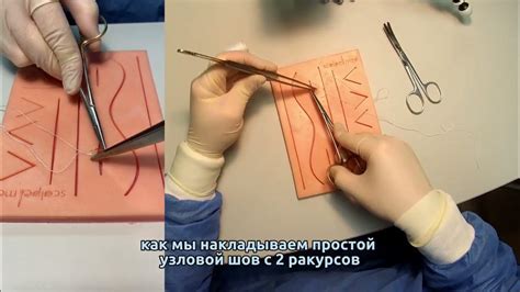 Методы лечения танталовых швов на легких