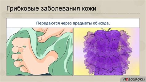Механические повреждения кожи