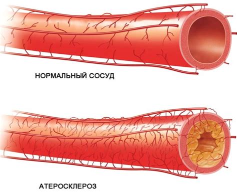 Повреждение желез и сосудов