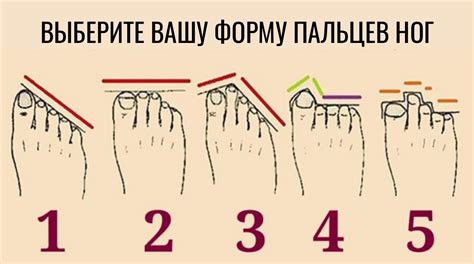 Сон: 6 пальцев на ноге